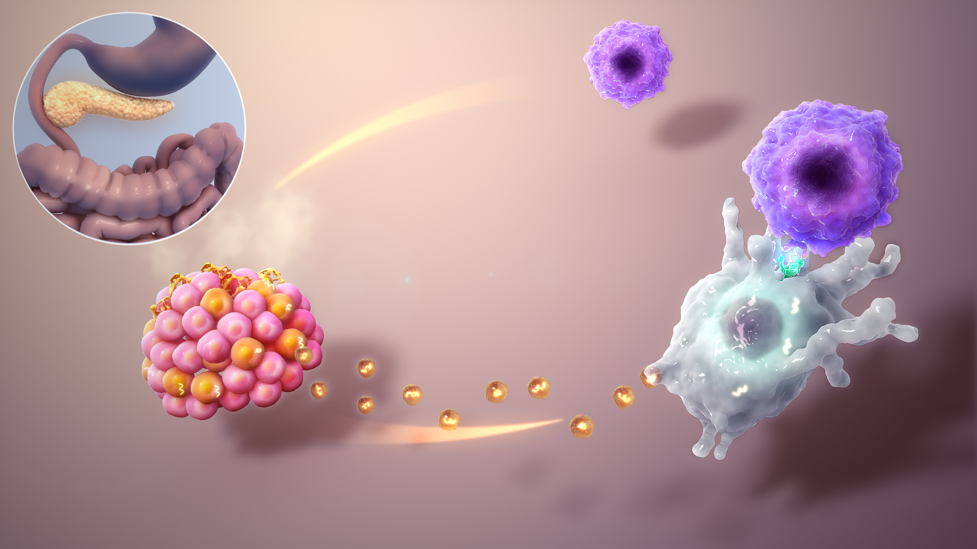 Diabetes Mellitus (DM) describes a complex metabolic disorder characterized by chronic hyperglycemia, resulting in abnormally high blood glucose concentrations.